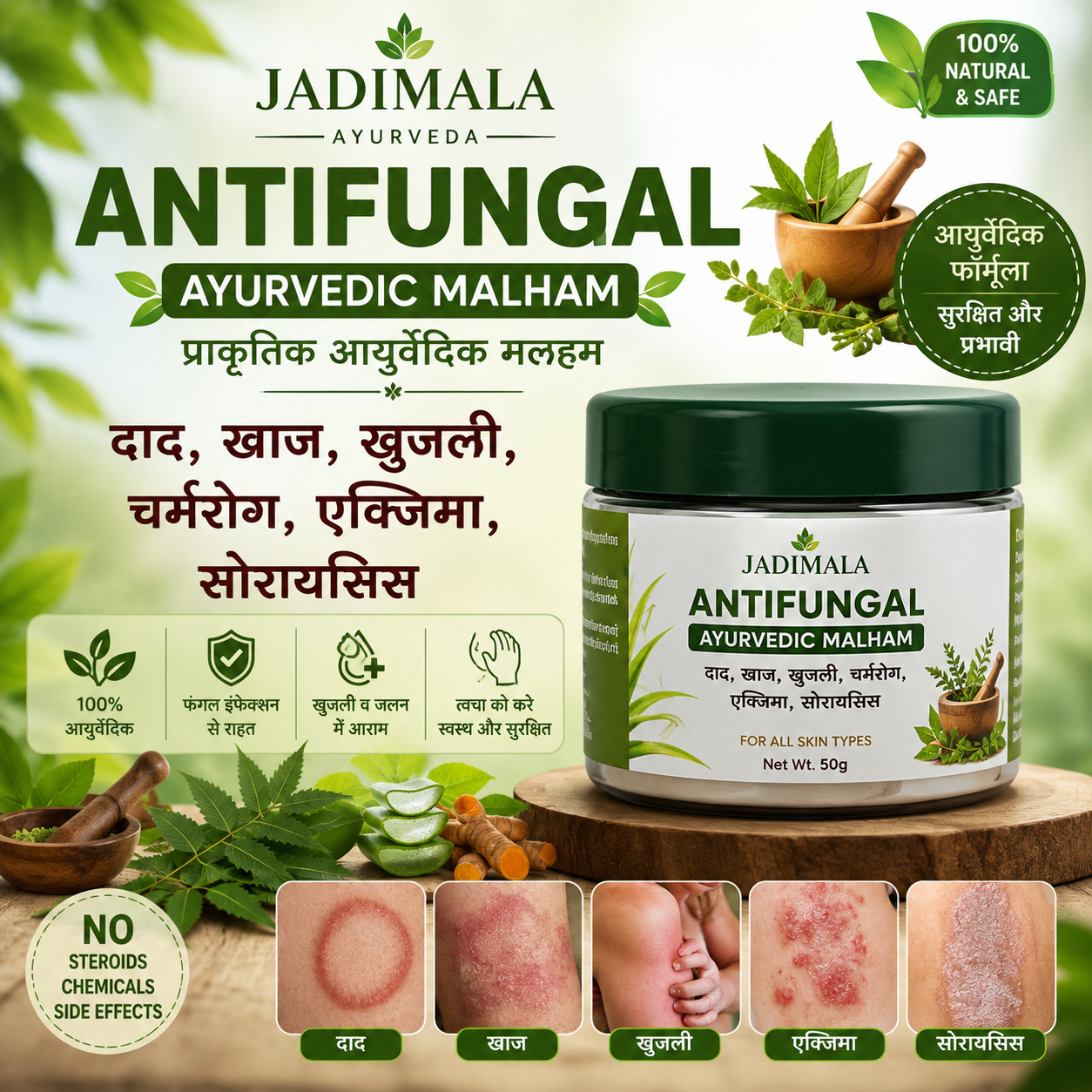 Jadimala Antigungal Ayurvedic Malham -दाद, खाज, खुजली, चर्मरोग, एक्जिमा, सोरायसिस